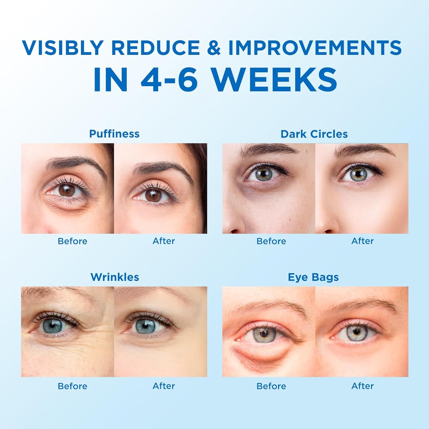 Retinol and Collagen Under Eye Gel Strips